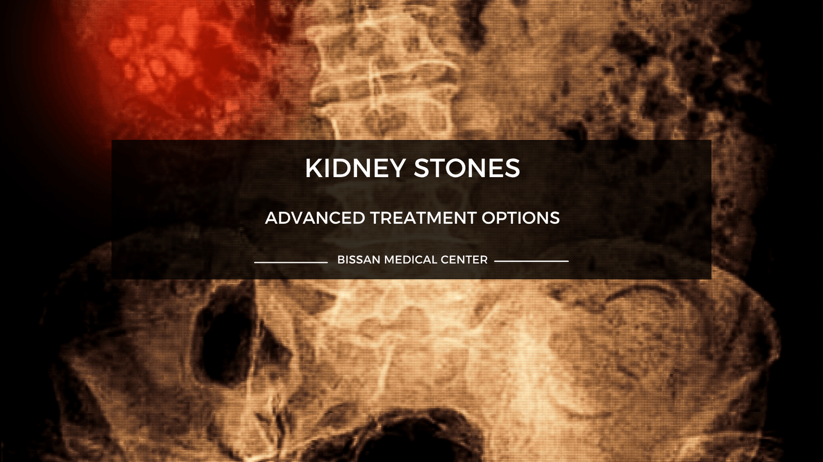Kidney stones evaluation at Bissan Medical Centre