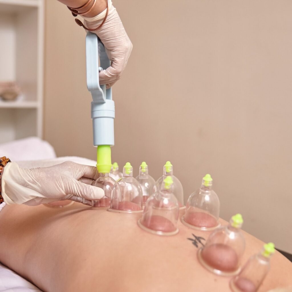 Hijama cupping therapy session in Sharjah