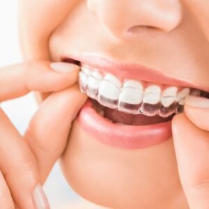 Orthodontics in Sharjah Spark clear aligners treatment