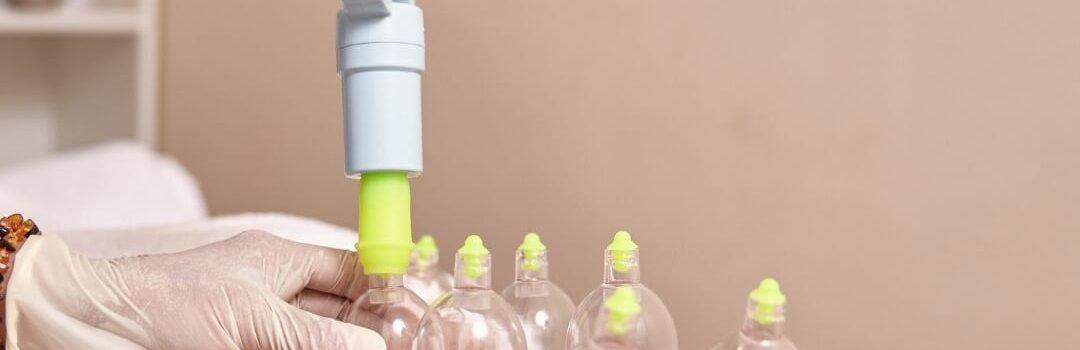 Hijama therapy in Sharjah at Bissan Medical Centre